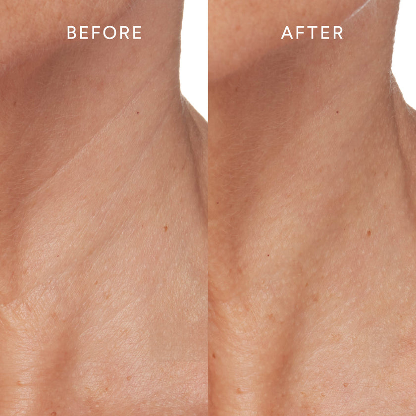 Sleep serum before and after