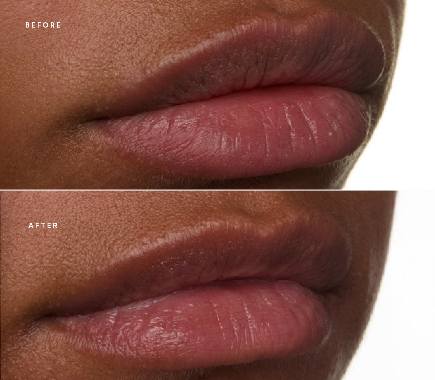 Before and after of lip images.