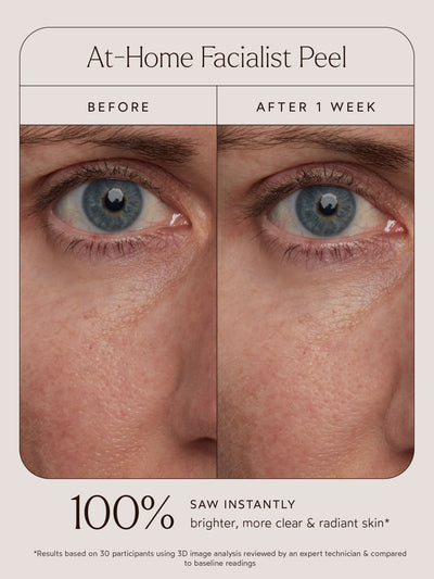 Before-and-after comparison of the At-Home Facialist Peel highlighting under-eye and cheek skin texture. The "Before" image shows dull and uneven skin, while the "After 1 Week" image reveals brighter, clearer, and more radiant skin. Accompanying text states: "100% saw instantly brighter, more clear & radiant skin." A note clarifies: "Results based on 30 participants using 3D image analysis reviewed by an expert technician & compared to baseline readings."
