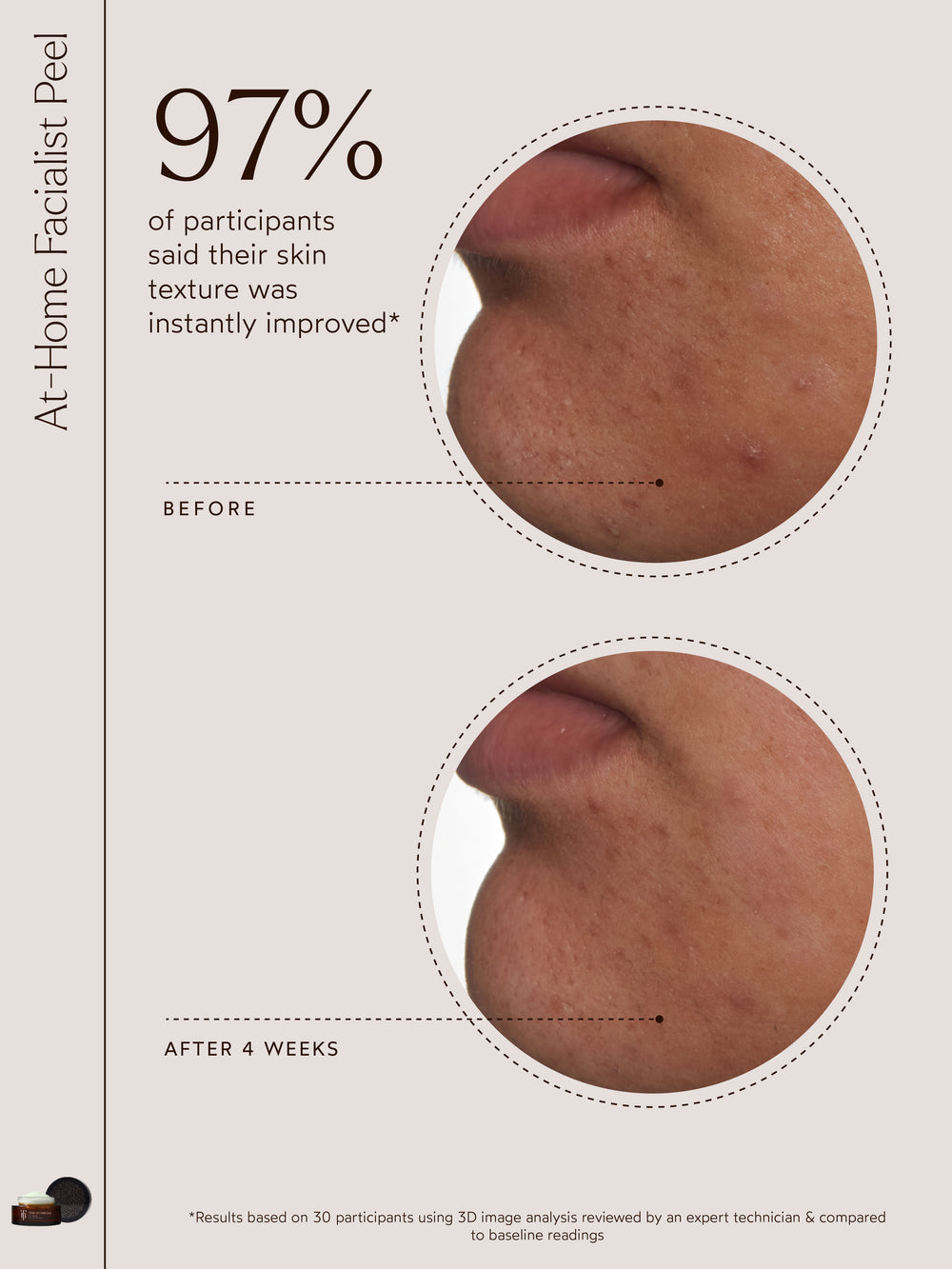 In a study of 30 participants, 97% reported an immediate improvement in skin texture after using the At-Home Facialist Peel. Results were measured using advanced 3D image analysis, highlighting this peel’s ability to deliver professional-level exfoliation and refinement from the comfort of home.