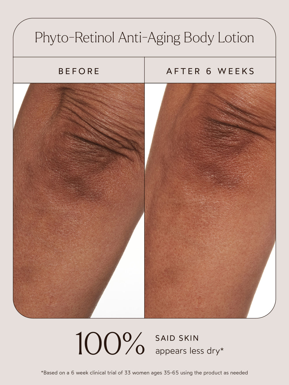 Before-and-after comparison showcasing the results of Phyto-Retinol Anti-Aging Body Lotion on knee skin. The "Before" image highlights dryness and visible wrinkles, while the "After 6 Weeks" image shows smoother and more hydrated skin. The text reads: "100% said skin appears less dry*" with a note that the data is based on a 6-week clinical trial of 33 women aged 35–65 using the product as needed.