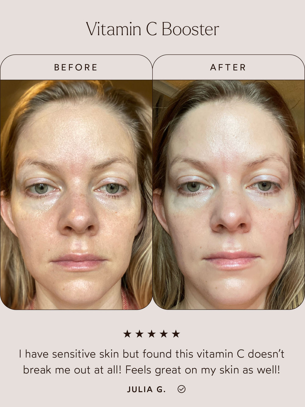 Before-and-after comparison of the Vitamin C Booster's effects on sensitive skin. The "Before" image shows uneven skin texture, while the "After" image displays smoother, more even skin with a radiant glow. Below, a customer review states: "I have sensitive skin but found this vitamin C doesn’t break me out at all! Feels great on my skin as well!" – Julia G. The review includes a five-star rating.
