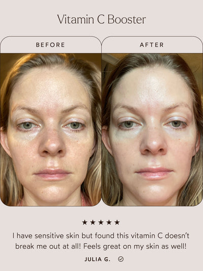 Before-and-after comparison of the Vitamin C Booster's effects on sensitive skin. The "Before" image shows uneven skin texture, while the "After" image displays smoother, more even skin with a radiant glow. Below, a customer review states: "I have sensitive skin but found this vitamin C doesn’t break me out at all! Feels great on my skin as well!" – Julia G. The review includes a five-star rating.