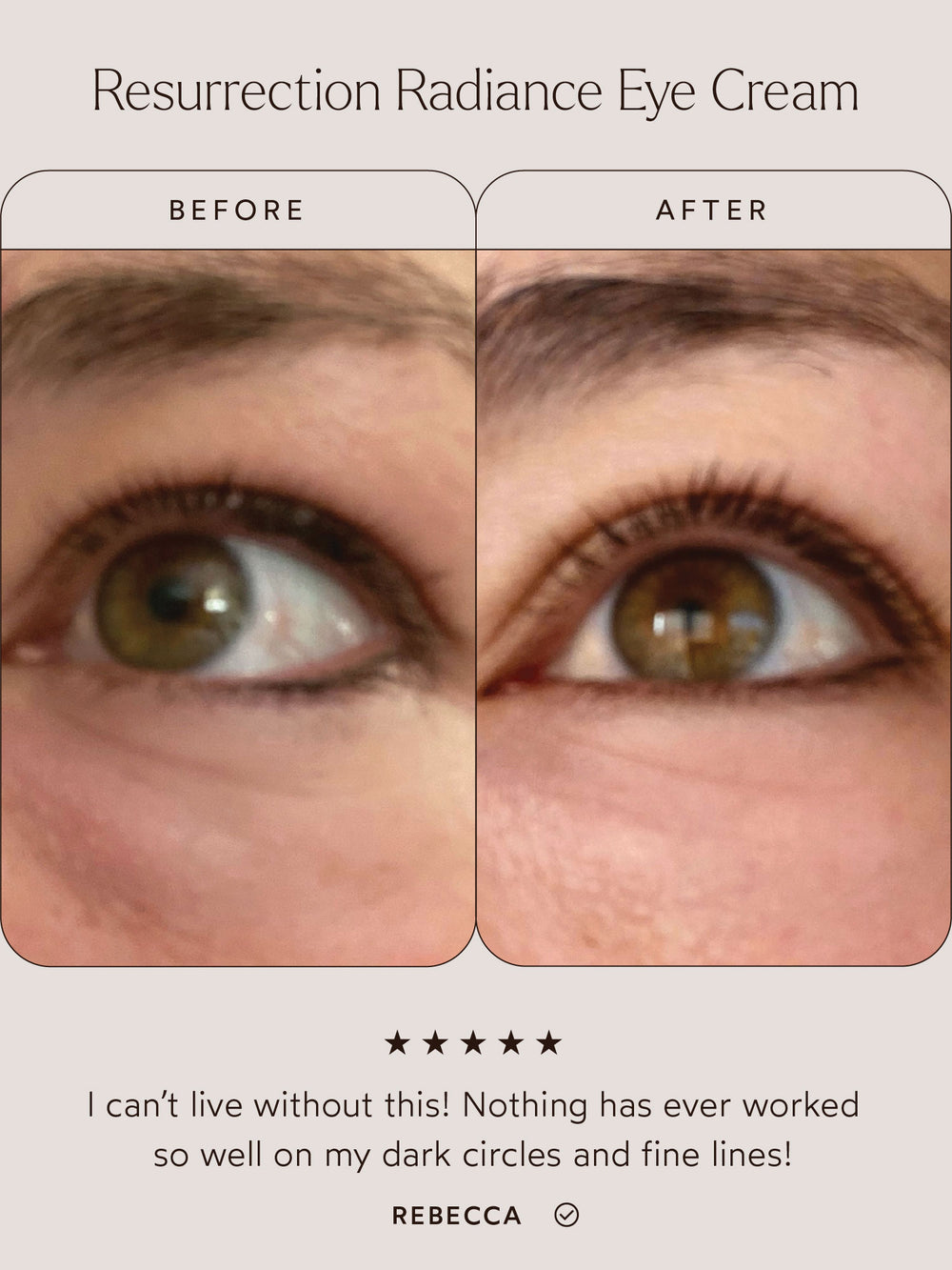 Before and after comparison of the eye area using Resurrection Radiance Eye Cream. The "Before" image shows visible dark circles and fine lines, while the "After" image reveals a brighter, smoother, and more refreshed appearance. Below the images, a testimonial reads: "I can’t live without this! Nothing has ever worked so well on my dark circles and fine lines!" – Rebecca.