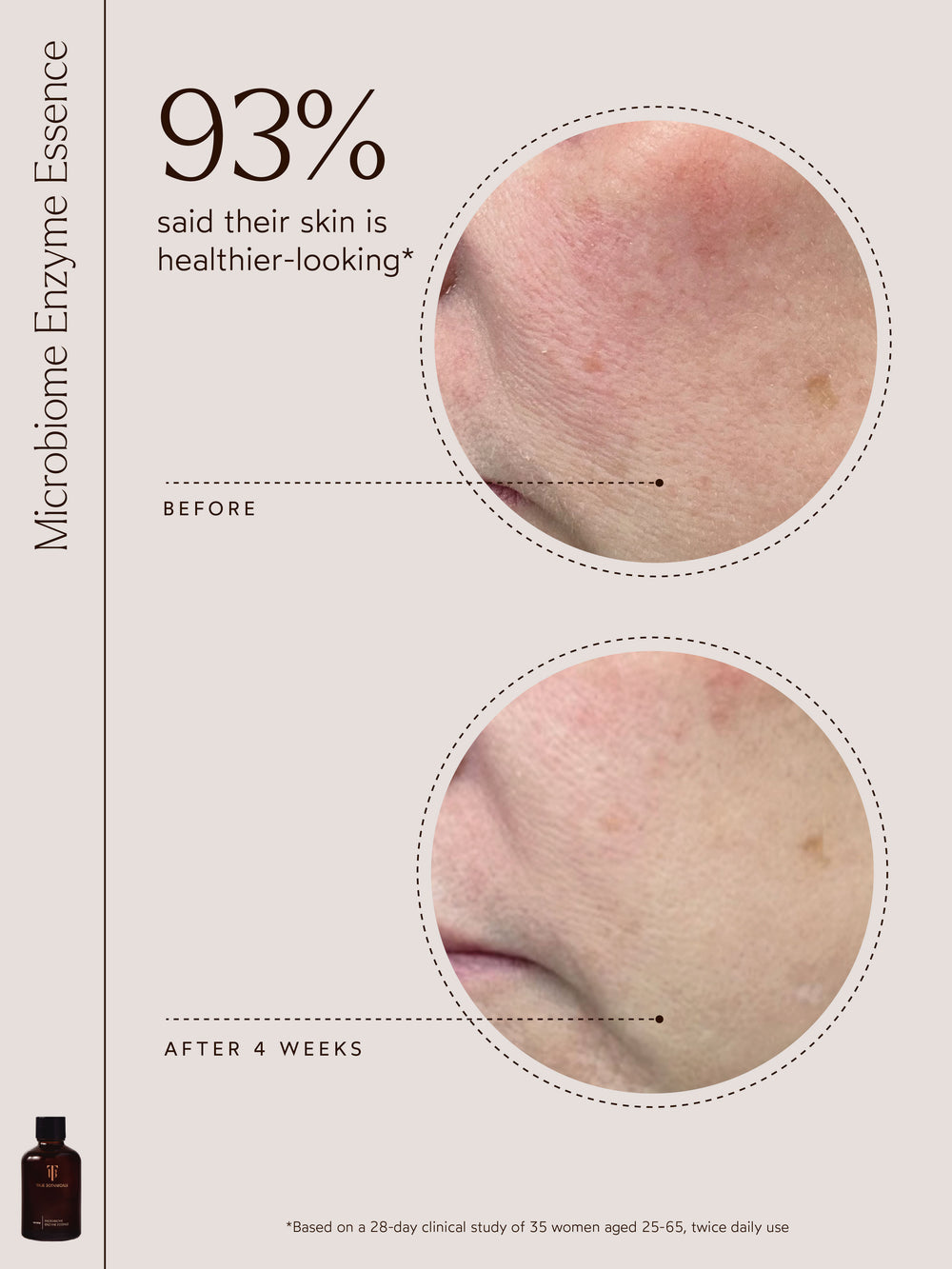 An image showing "93% said their skin is healthier-looking*" with before and after close-ups of skin improvement after 4 weeks. A Microbiome Enzyme Essence bottle is featured, with study details below.