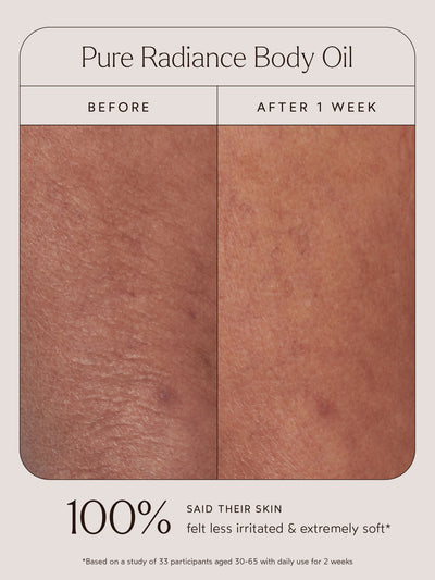 
Before and after comparison of a close-up of skin using Pure Radiance Body Oil. The left image shows skin before use, with visible dryness and irritation, while the right image, labeled "After 1 Week," displays softer, more hydrated, and calm skin. Below the images, text highlights that 100% of participants said their skin felt less irritated and extremely soft, based on a study of 33 participants aged 30–65 with daily use for 2 weeks.